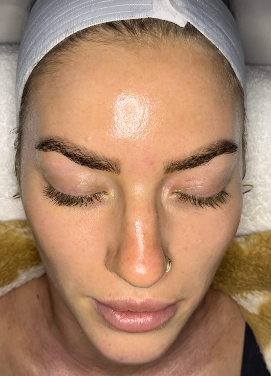 A client resting during a chemical peel appointment at Skin Restore, San Clemente